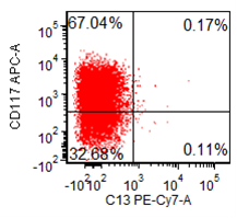 Figure 6d: Flow cytometry, peripheral blood. Blasts (red) are CD45+ (moderate), CD7+, CD11b+, CD34+, and CD117+ (partial). Surface CD3 is negative.